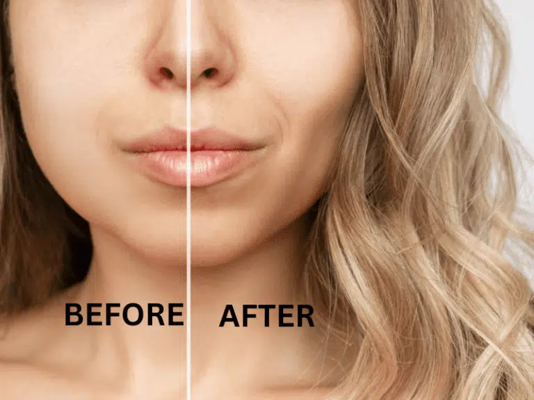 How to Reduce Face Fat